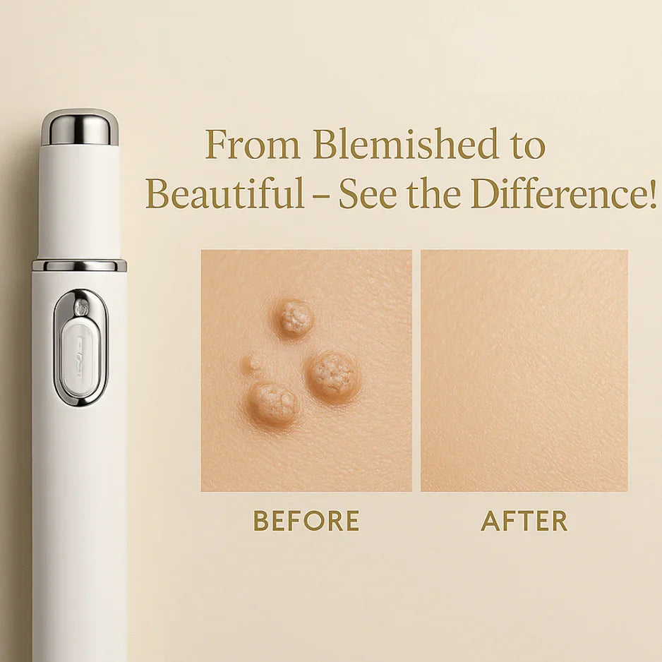 WartAway Laser Pen - Allmarrtt